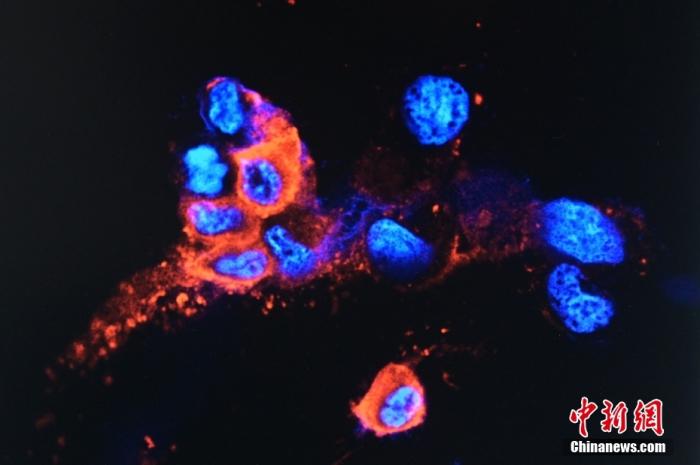 奥密克戎,奥密克戎蔓延速度,奥密克戎毒株的稳定性 奥密克戎,奥密克戎蔓延速度,奥密克戎毒株的稳定性
