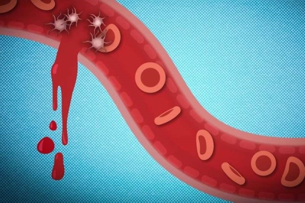 纳米粒子,血小板,创伤性损伤 纳米粒子,血小板,创伤性损伤