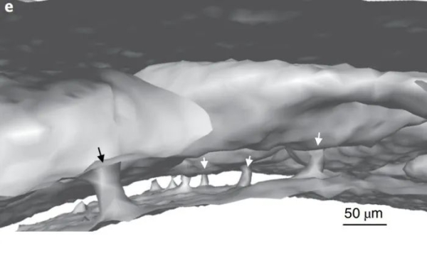 成像,组织,中性粒细胞 成像,组织,中性粒细胞