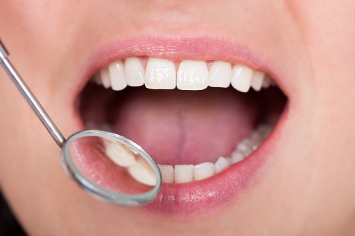 治疗前先控制好磨像服,牙周炎早期主要表现为牙龈出血