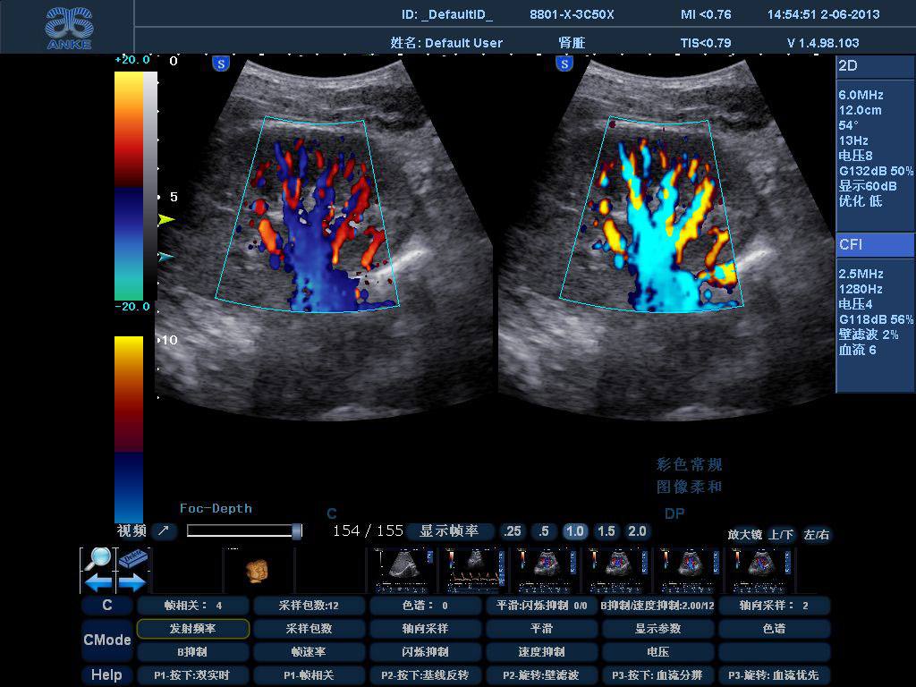超声心动图实用指南正常和异常心脏第三3版刘琳主译产前胎儿心脏筛查 - 动态图库网