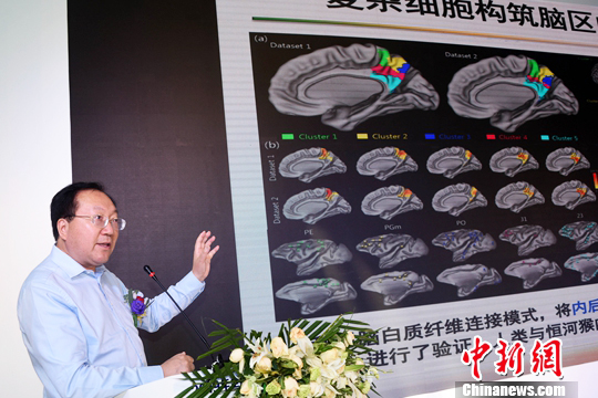 蒋田仔;中科院自动化所;脑网络组研究中心主任