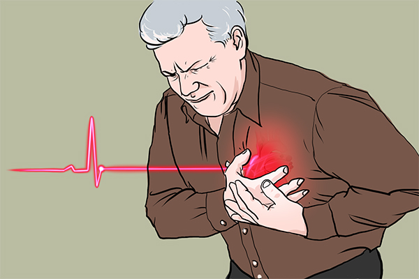 自动体外除颤器;AED;AED设备;心脏骤停