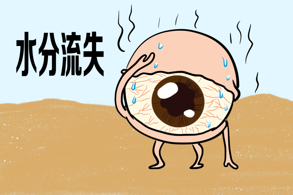 干眼症分型,角膜结膜干燥症,眼表疾病 干眼症分型,角膜结膜干燥症,眼表疾病