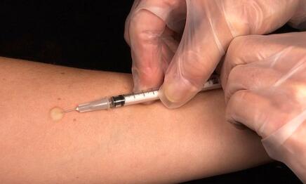 ¿Qué es la tuberculosis? ¿Qué es la tuberculosis?