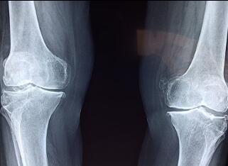 What Is X-ray? Part II What Is X-ray? Part II