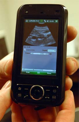 phone-ulltrasound-image