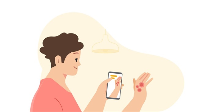 AI网络问诊！谷歌将于年内推出AI皮肤病检测APP，你觉得可靠吗？