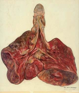 生命世界：追踪杀人流感(组图)