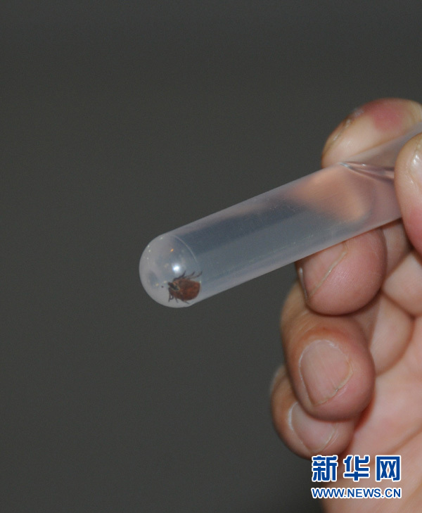 夺命蜱虫,蜱虫和普通虫子有什么不一样,为什么被蜱虫叮咬后可能会危及生命呢