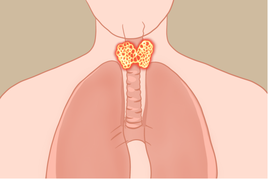 甲状腺结节,甲状腺结节患病率