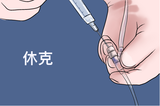 低血压休克,低血压休克的临床表现,出血热的发热期