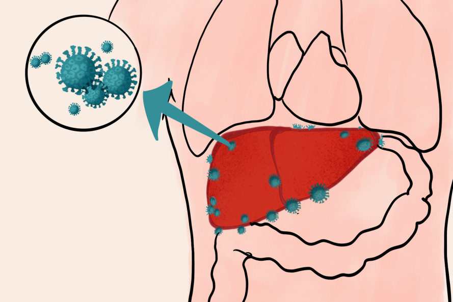 嗜肝病毒,非嗜肝病毒,病毒性肝炎