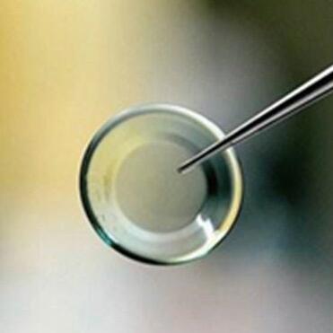 角膜塑形镜能治疗近视?