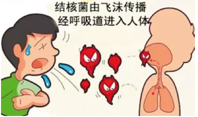 结核病;肺结核;健康;白色瘟疫