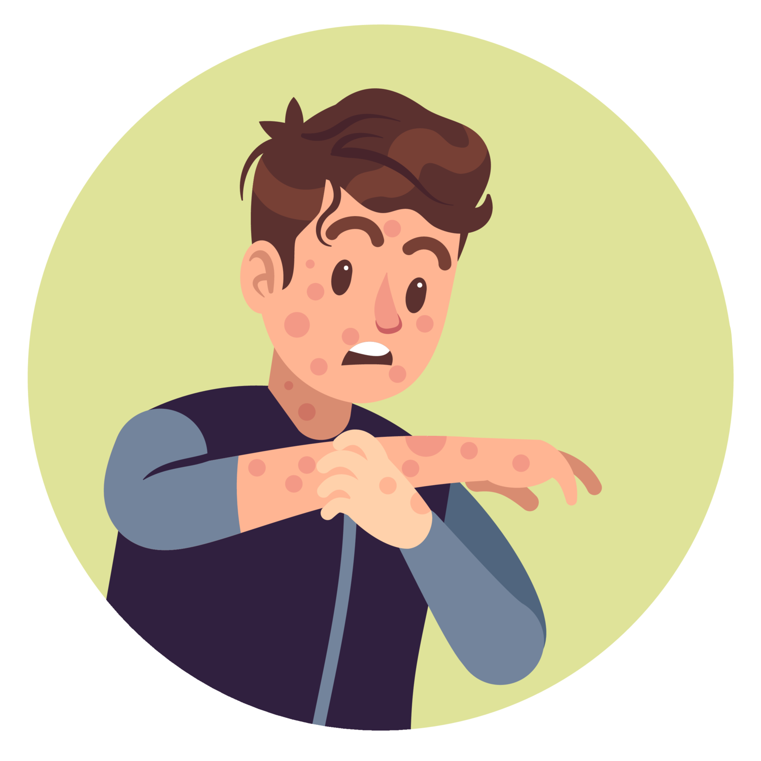 春季过敏,湿疹,过敏性皮炎