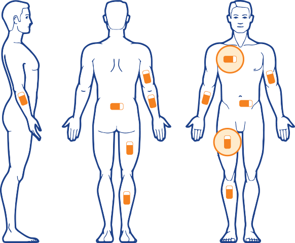 电子皮肤;艾米·穆林斯 电子皮肤;艾米·穆林斯
