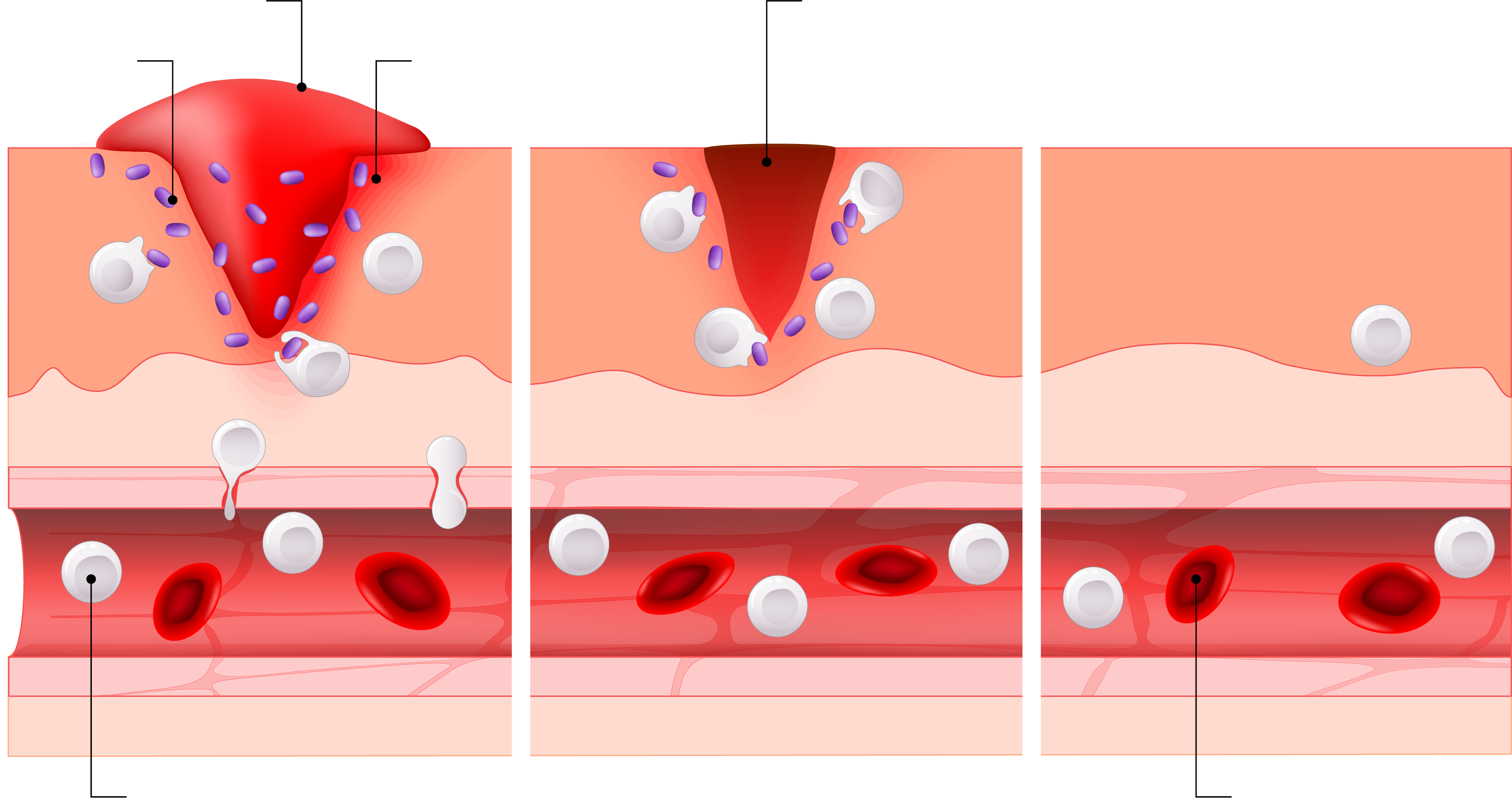 电子皮肤;艾米·穆林斯 电子皮肤;艾米·穆林斯