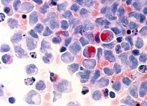 最新研究：宇航员血液样本中可能带有基因突变？